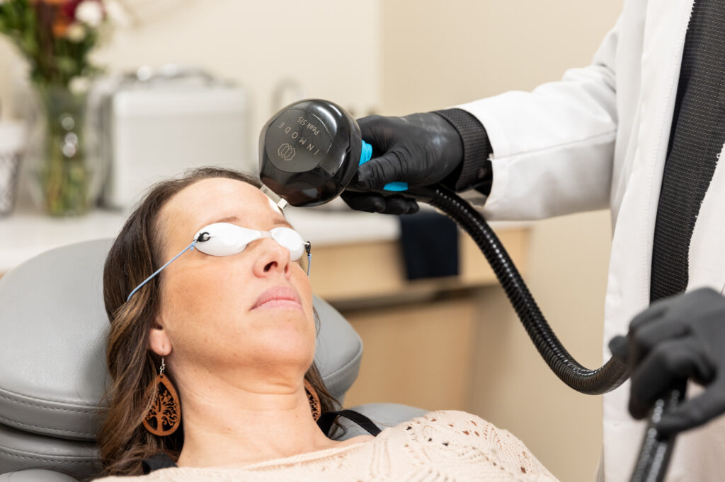 A woman wearing eye protection receives IPL