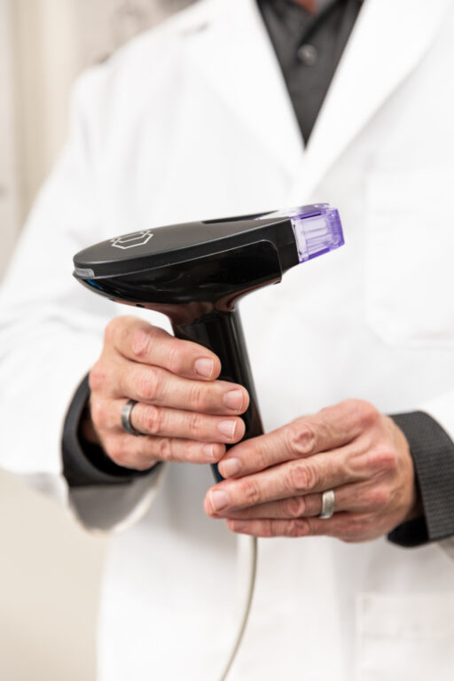 A provider holds a microneedling applicator