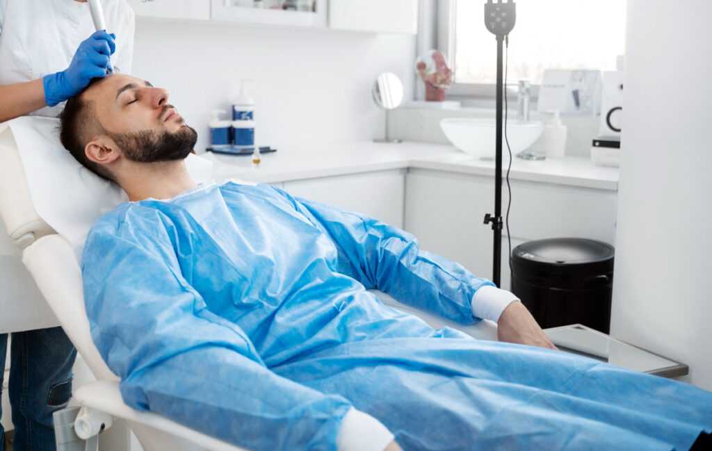 microneedling-hair-loss